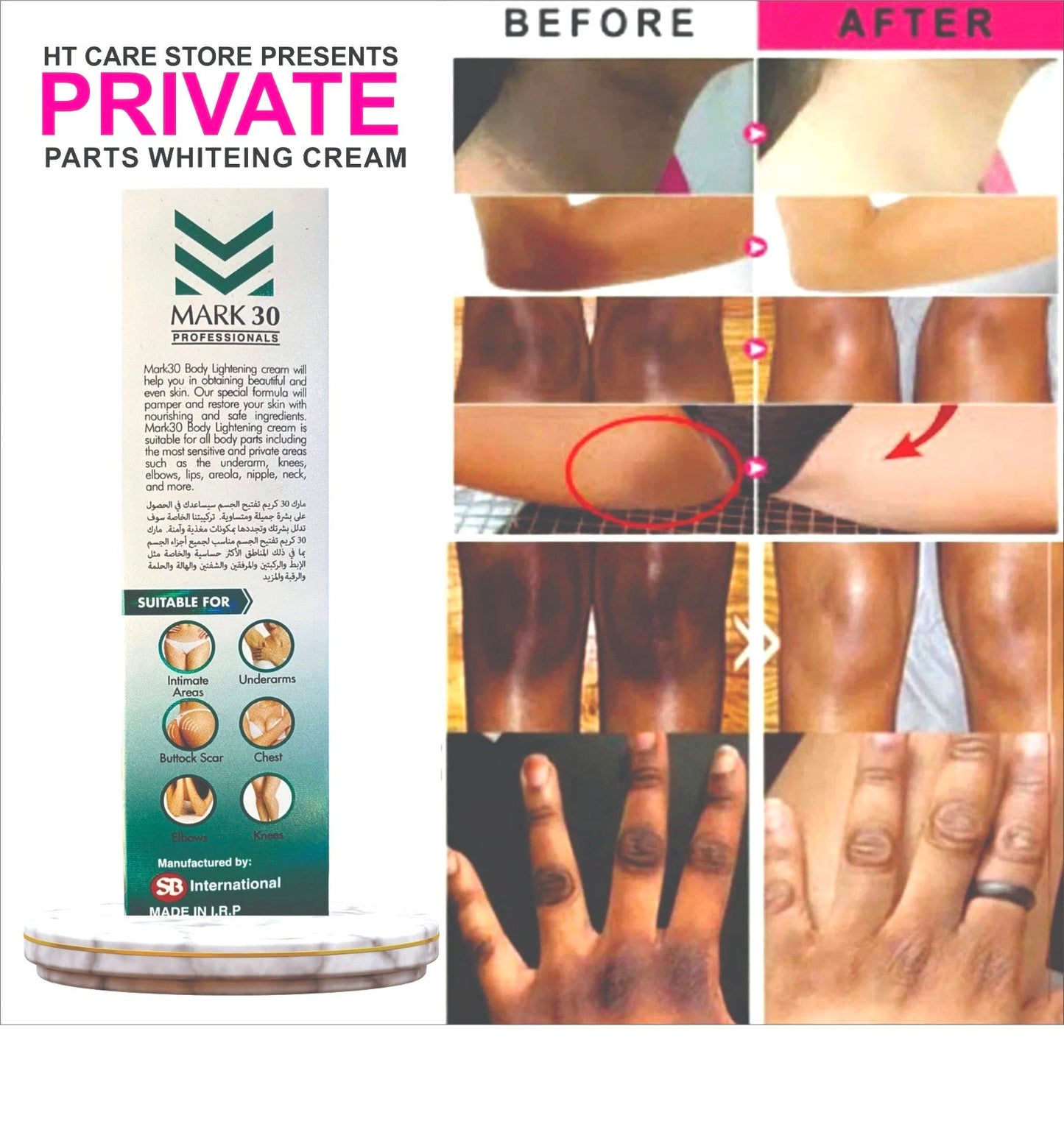 Underarms whiteing Cream